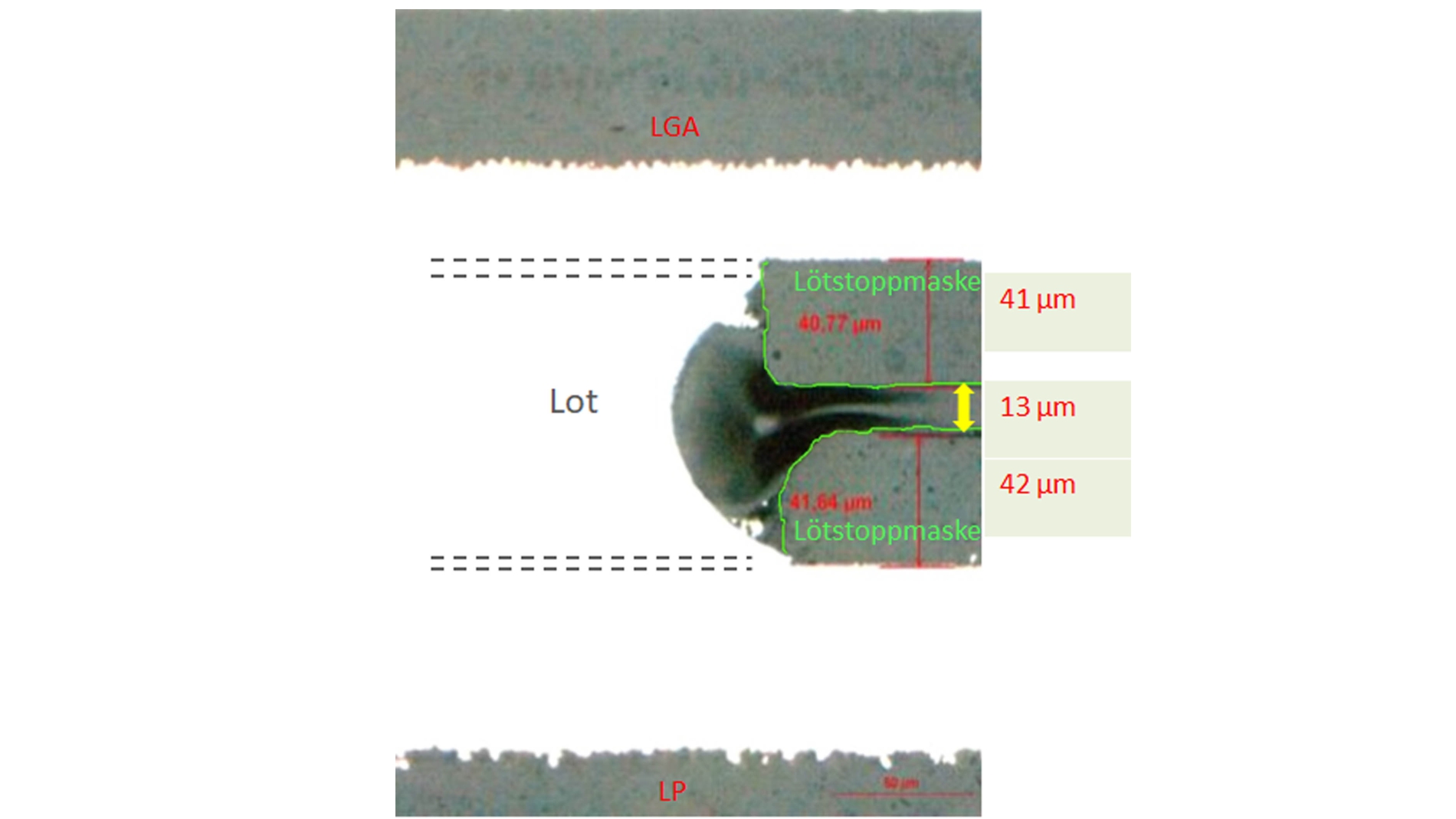 Dark field image of an LGA solder joint